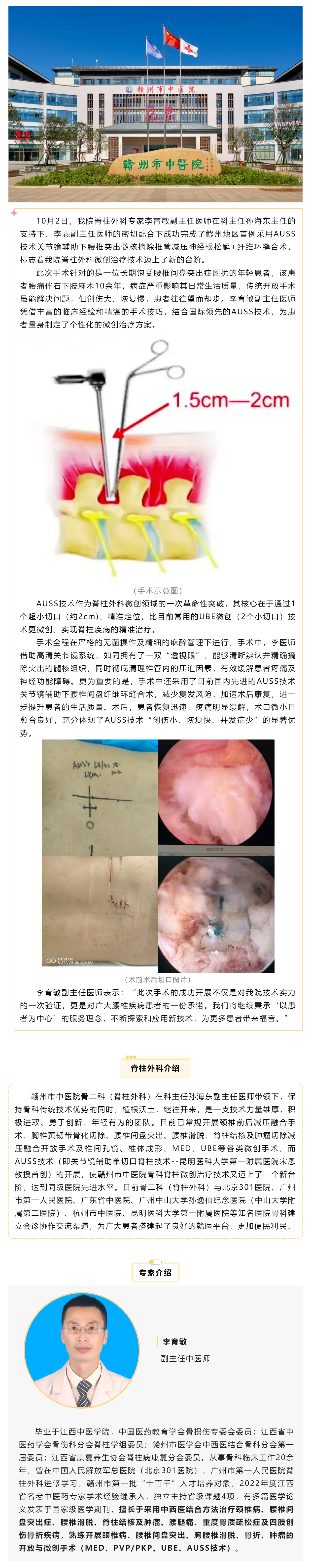 全市首例！我院成功實(shí)施AUSS技術(shù)關(guān)節(jié)鏡輔助下腰椎突出髓核摘除椎管減壓神經(jīng)根松解+纖維環(huán)縫合術(shù).png